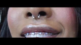 DreamMovies Black Girl Teeth Brace Fetish! - Pornhub.com Oral Porn - 1