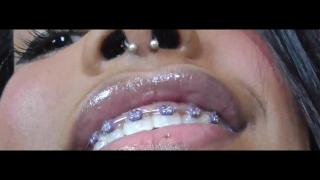 Black Girl Teeth Brace Fetish! - Pornhub.com 8